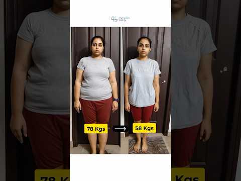 20 kgs Weight Loss + Face Fat Loss (Online)